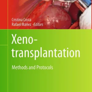 Xenotransplantation | 1:a upplagan Populär
