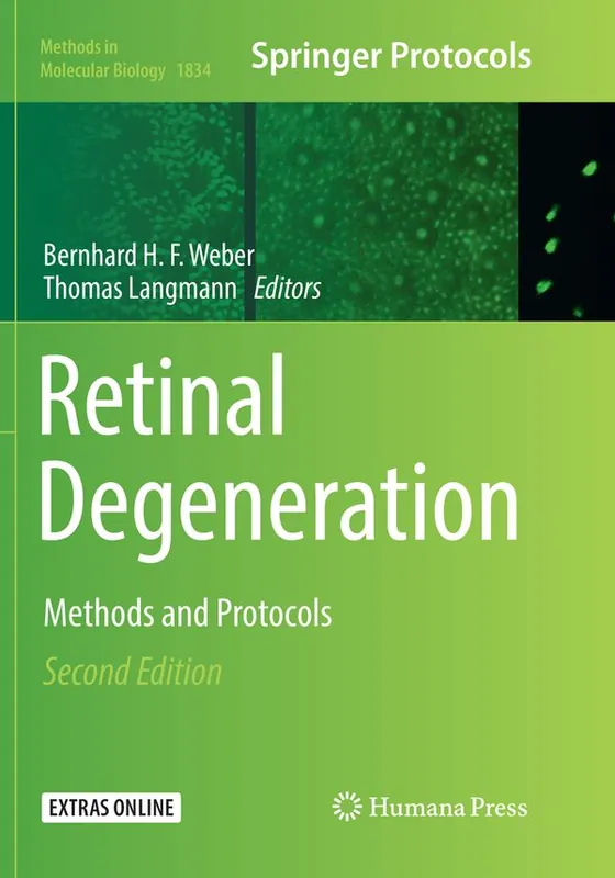 Retinal Degeneration | 2:a upplagan Beställ nu