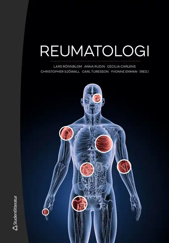 Reumatologi | 4:e upplagan Populärt val