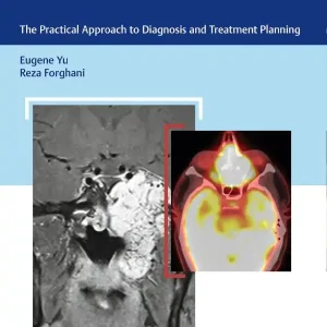 Rabatt Skull Base Cancer Imaging | 0:e upplagan