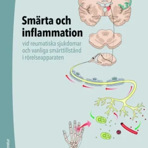 Smärta och inflammation - vid reumatiska sjukdomar och vanliga smärttillstånd i rörelseapparaten | 2:a upplagan Fynd