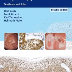 Kundfavorit Burghardt's Primary Care Colposcopy | 2:a upplagan