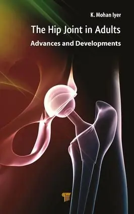 Hip Joint in Adults | 1:a upplagan risnedsättning