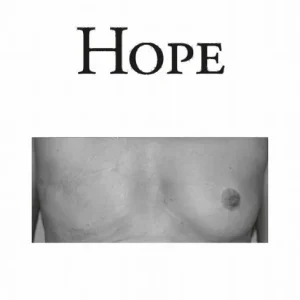 Endast denna vecka Hope | 2:a upplagan