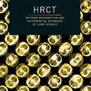 Nyhet HRCT – Pattern Recognition and Differential Diagnosis of Lung Disease | 5:e upplagan