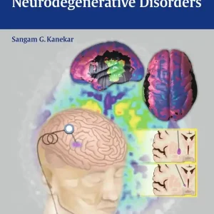 Imaging of Neurodegenerative Disorders | 0:e upplagan Sänkt pris