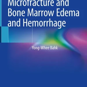 Begränsat antal Imaging of Trabecular Microfracture and Bone Marrow Edema and Hemorrhage | 1:a upplagan