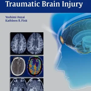 Outlet Imaging of Traumatic Brain Injury | 0:e upplagan
