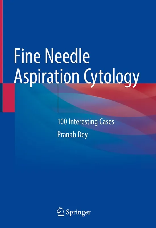 Populärt val Fine Needle Aspiration Cytology | 1:a upplagan