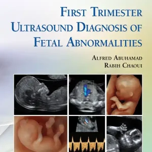 First Trimester Ultrasound Diagnosis of Fetal Abnormalities | 0:e upplagan Premium