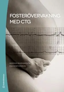 Trygg betalning Fosterövervakning med CTG | 2:a upplagan